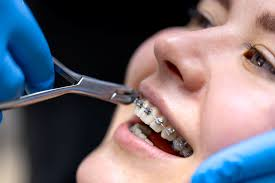 image - Lead Grow Develop - Business, Technology, Personal Development orthodontist treating a patient