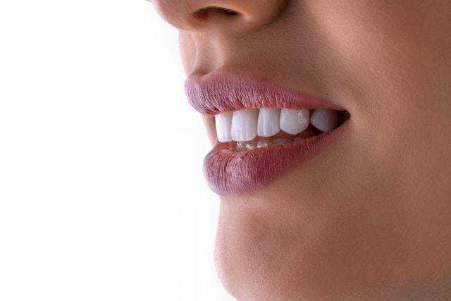 white bright teeth